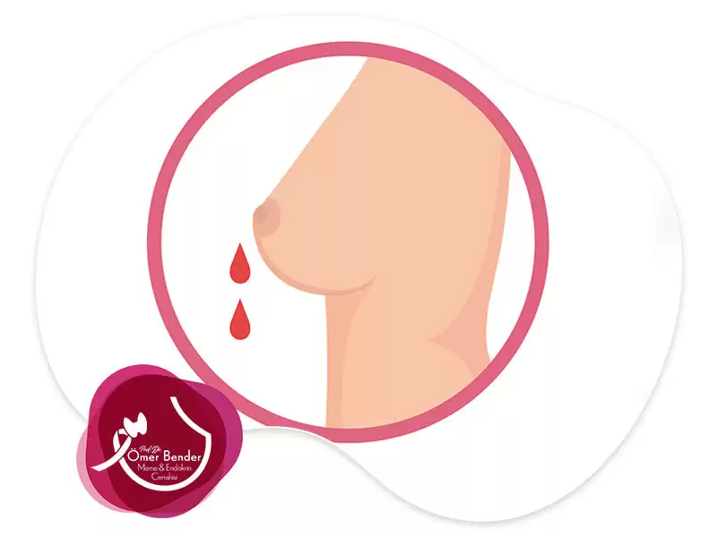 meme-ucundan-kan-gelmesi