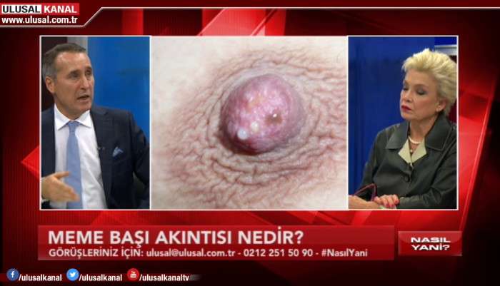 video,paylaşım,kameralı telefon,videofon,ücretsiz,yükleme